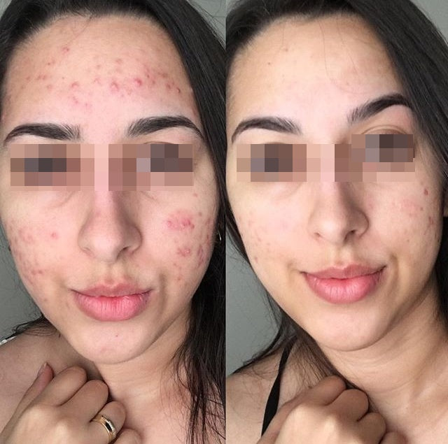 Avaliação de Ana Costa